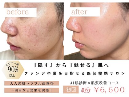 パリス(PALIS)の写真