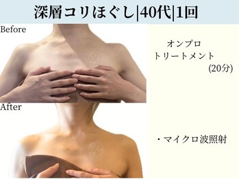 京都フォーエイチ(京都4H)/辛すぎる肩・首こり改善|40代