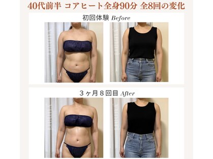 ユナリ(yunari)の写真