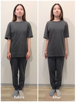 いとう美容整体/☆立ち姿勢正面のBefore After☆
