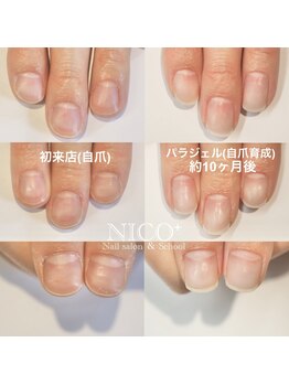 ニコプラス(NICO+)/自爪育成中
