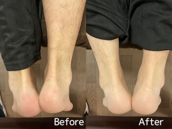 チアーライフ整体/骨盤矯正の効果/マッサージ/小顔