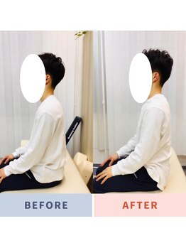 ナオル整体 三鷹院(NAORU整体)/20代男性施術事例【猫背姿勢】