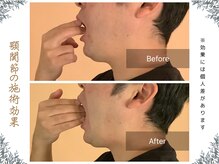 ボディ リセット アンド デザイン(Body Reset & Design)/【施術例】ビフォーアフター