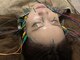 マル(malu)の写真/【大人気の美容鍼を体験◎】術後すぐに効果を体感できる、速効性の高い電気あり！美容鍼¥4300～