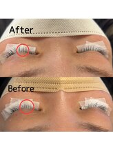 イッシュ(-ish)/【エクソソーム美容液】