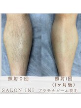 サロン イニ(SALON INI)/《LEDプラチナビーム脱毛》