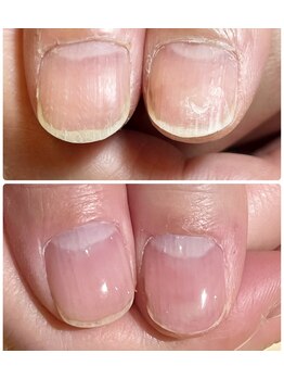 ミリアネイル 成城(Miliea nail)/