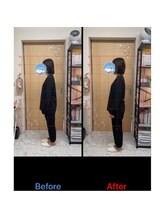 おひさま整体/1回施術後の重心の変化