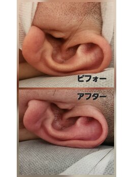 スマイリー(smiley)/