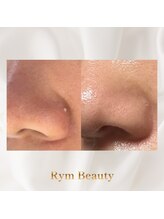 リム ビューティー(RYM BEAUTY)/ニキビケア