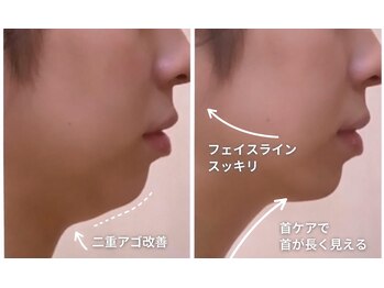 ルーム701(room701)/二重アゴ/たるみ/印象改善