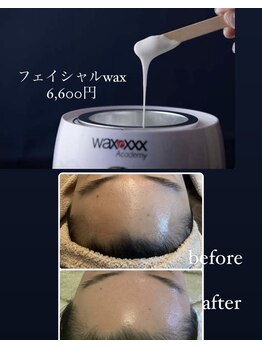 ソラ 六本松店(SORA)/waxXXX★フェイシャルwax