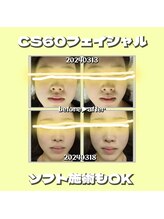 リボーン(Reboorn)/