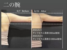 ミルジュ(MiLuJu)/美容溶解エンマ