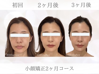 ビスイ 恵比寿(Bisui)の写真