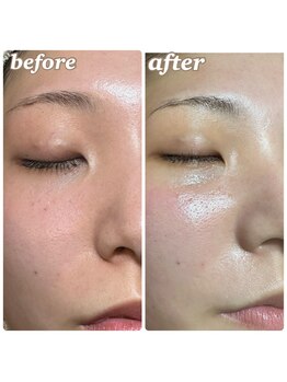 アンレーヴ 津幡店/フェイシャルWAＸでつやぴかお肌