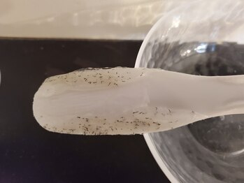 メンズ脱毛サロン アカラ(AKALA)/効果が目に見える