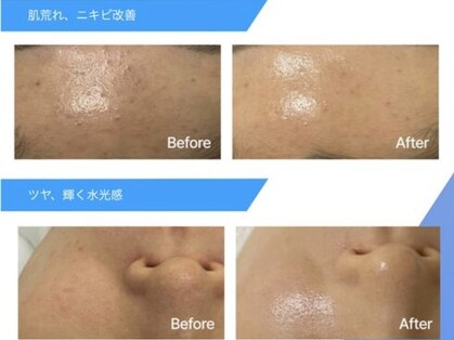 ジャミングレブ 六本木(jammmingrev)の写真