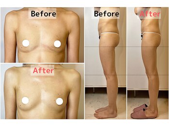 ロットプラス(Lot Plus)/Before→After（約3ヶ月の変化）