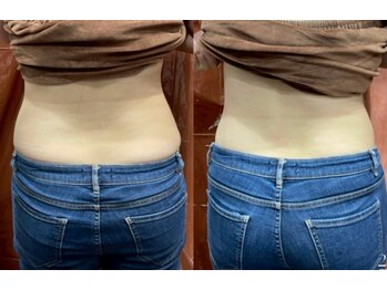 ブーラン(BULAN)/腰回りには絶対これ