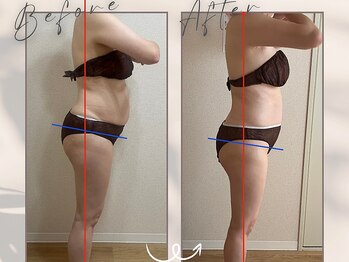 ブルーム(BLOOM)/体重は同じでもスタイルで細見え