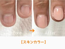 レアム/いつも目に入る爪だから。