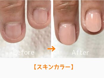 レアム/いつも目に入る爪だから。