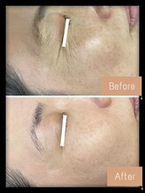 FJ/エイジングケア◎