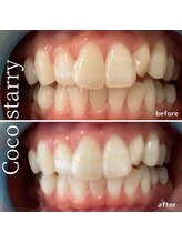 ココスターリー(Coco starry)/清潔感アップで好感度もアップ♪