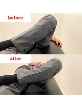 ナオル整体 福岡香椎院(NAORU整体)/40代男性施術事例【股関節】