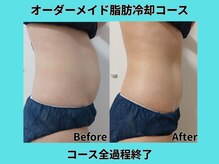 ホワイトビューティーラボ(White Beauty Lab)