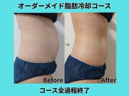 ホワイトビューティーラボ(White Beauty Lab)の写真