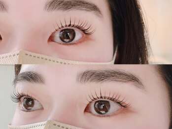 ナイロ(NiLO)の写真/「少ない・下がる」などの悩みに寄り添う丁寧なカウンセリング！1対1のプライベート空間でお気軽にご相談◎