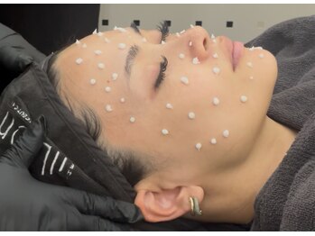 美温(mion)/植えるエクソソーム