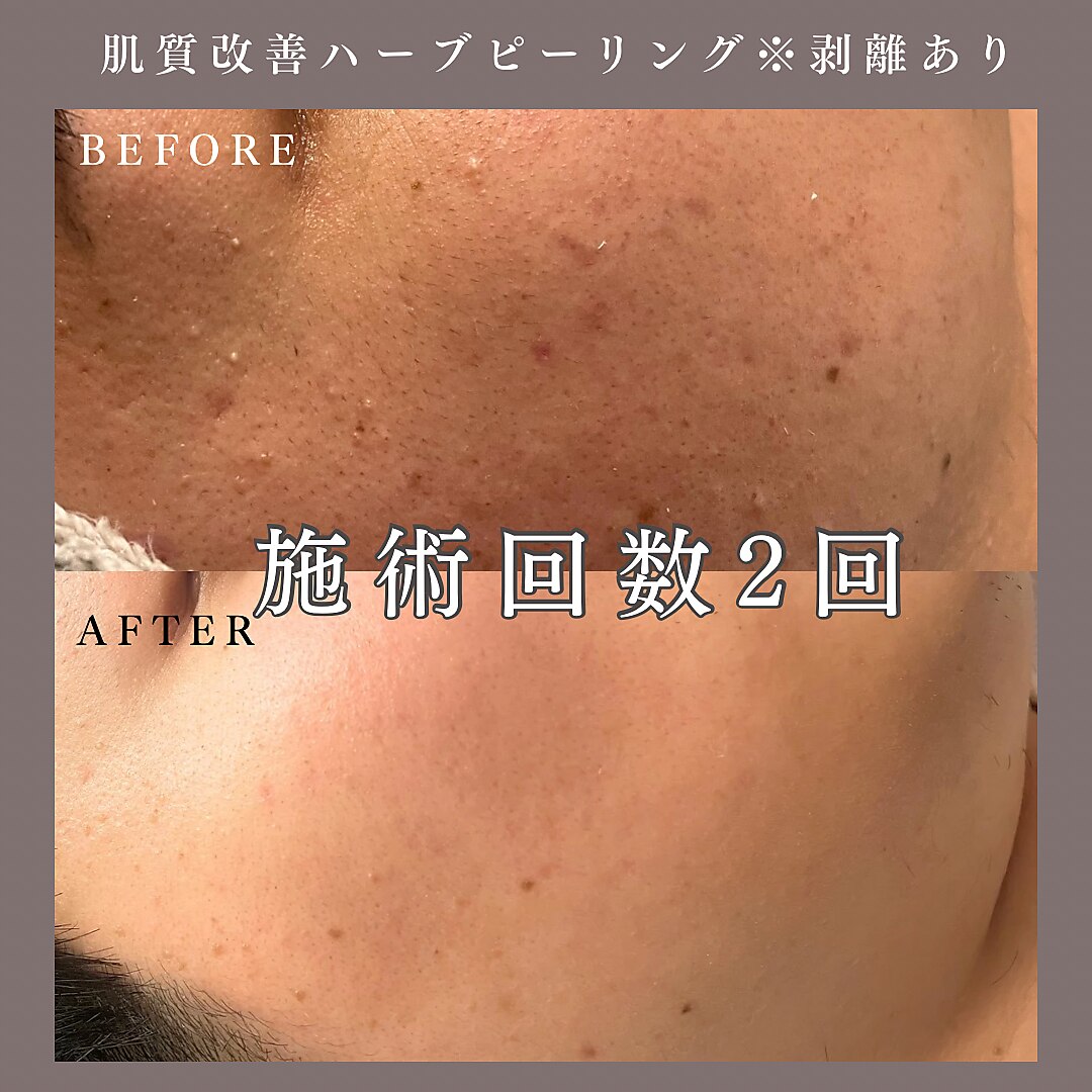 ベルミー(Bellmi)｜ホットペッパービューティー