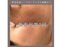 ベルミー(Bellmi)