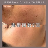 ベルミー(Bellmi)