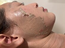 アンビエント(ambient)の雰囲気（グリーンピールハーブは無理やり剥がすピーリングとは全くの別物）