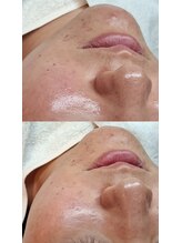 バリューネクスト 青葉台/◆マンデルホワイトピール◆