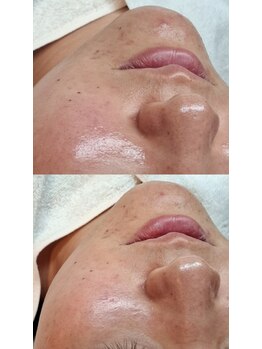 バリューネクスト 青葉台/◆マンデルホワイトピール◆