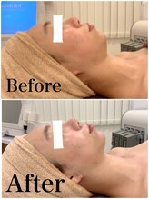 スペチアーレ 夙川/引き上げて横顔も美しく