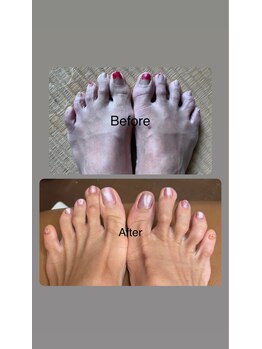 オハナ(OHANA)/フットネイル