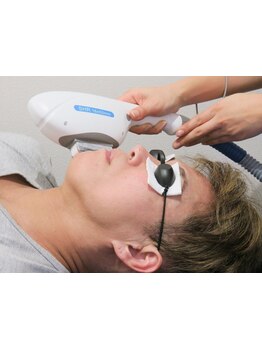 顔脱毛がしたい