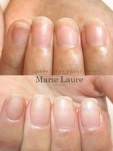 マリーロール 淀屋橋本店(Marie Laure)/自爪育成/深爪矯正/ネイルケア
