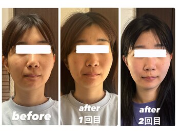 ボーンズ(BONES)/