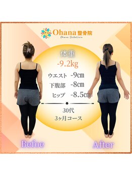 オハナ整骨院(Ohana整骨院)/30代　-9キロダイエット