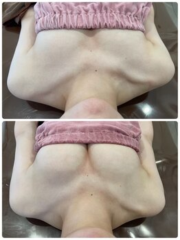 ロココ 豊田店(Rococo)/ビフォーアフター