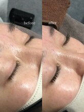 サロンパルヨン ヘアー アンド ネイル(SALON paljon Hair&Nail)/大人ナチュラルエクステ