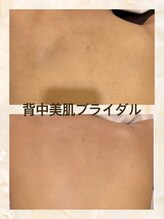 セーラマーレ(cera-mare Esthetic by CARDIA)/ブライダル背中美肌ケア